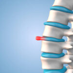 Soluções para Dor Lombar em Atibaia – Fisioterapia Especializada