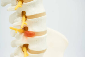 realidade virtual na reabilitação