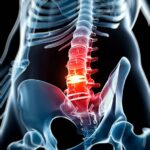 Dores Lombares: Estratégias de Fisioterapia que Promovem Alívio Imediato e Duradouro